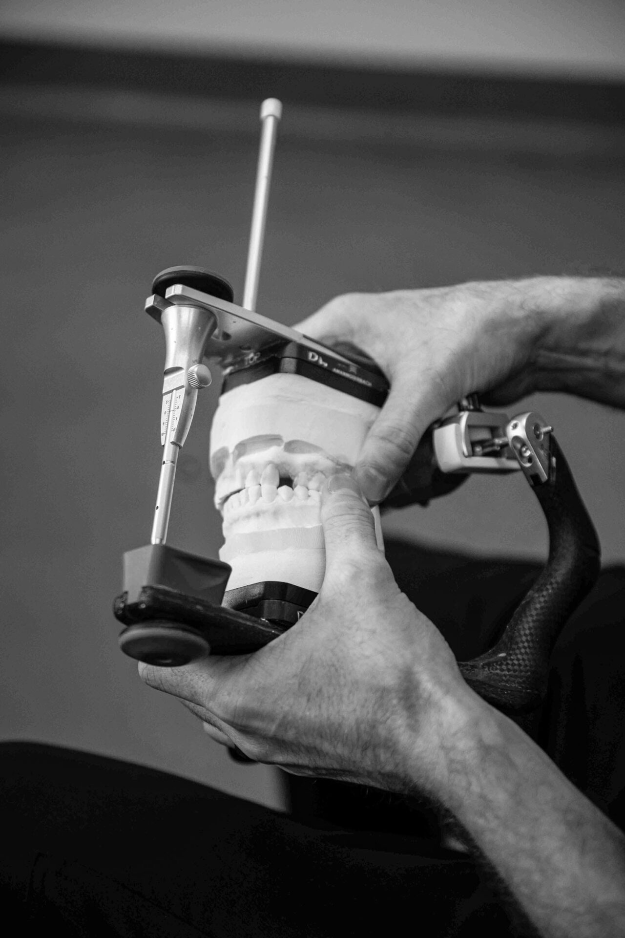 Prosthedontics Service Image